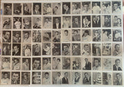 Ben Casey & Dr. Kildare Vintage Trading Card Set 110 Cards Topps 1962 - TvMovieCards.com